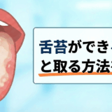 白い舌が口臭の原因？今すぐ取れる舌苔ケア方法